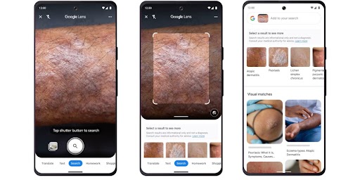 L'outil Google Lens qui détecte des problèmes de peau